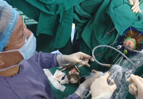  Phẫu thuật nội soi cắt trực tràng qua đường hậu môn(TaTME)